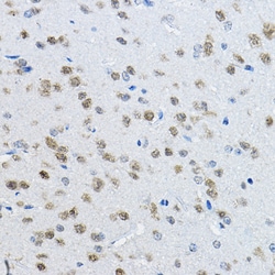 Invitrogen NeuN Polyclonal Antibody 100 &mu;L; Unconjugated:Antibodies,