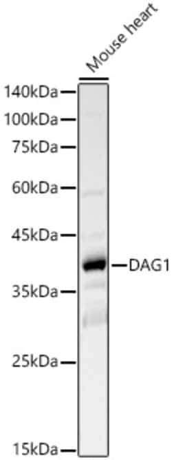 Invitrogen alpha Dystroglycan Polyclonal Antibody 100 &mu;L; Unconjugated:Antibodies,