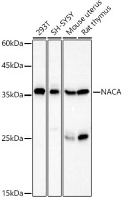 Invitrogen NACA Polyclonal Antibody 100 &mu;L; Unconjugated:Anticorps,