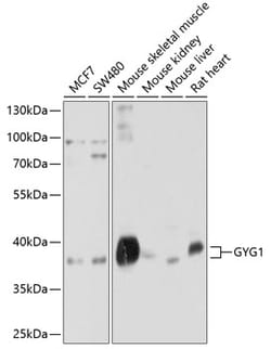 Invitrogen GYG1 Polyclonal Antibody 100 &mu;L; Unconjugated:Antibodies,