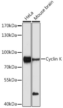 Invitrogen CCNK Polyclonal Antibody 100 &mu;L | Buy Online | Invitrogen&trade; | Fisher Scientific