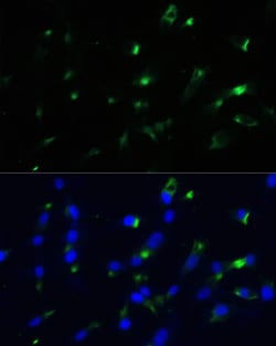Invitrogen ENO1 Polyclonal Antibody 100 μL; Unconjugated:Antibodies,