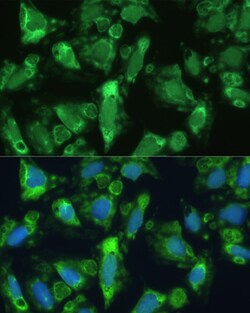 Invitrogen ENO1 Polyclonal Antibody 100 μL; Unconjugated:Antibodies,