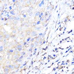 Invitrogen ENO1 Polyclonal Antibody 100 μL; Unconjugated:Antibodies,