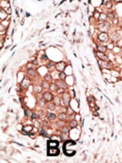 Invitrogen HPCAL1 Polyclonal Antibody 400 &mu;L; Unconjugated:Antibodies,