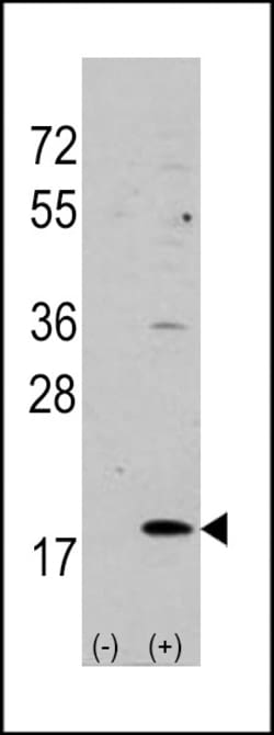 Invitrogen HPCAL1 Polyclonal Antibody 400 &mu;L; Unconjugated:Antibodies,