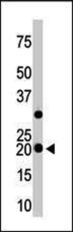 Invitrogen HPCAL1 Polyclonal Antibody 400 &mu;L; Unconjugated:Antibodies,