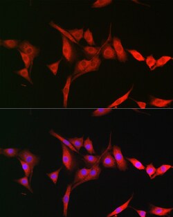 Invitrogen TRIM31 Polyclonal Antibody 100 &mu;L; Unconjugated:Antibodies,