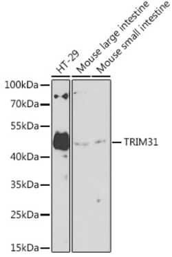 Invitrogen TRIM31 Polyclonal Antibody 100 &mu;L; Unconjugated:Antibodies,
