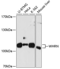 DFNB31 Polyclonal Antibody, Invitrogen 100 &mu;L; Unconjugated:Antibodies,