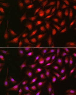 Invitrogen ERK2 Polyclonal Antibody 100 &mu;L; Unconjugated:Antibodies,