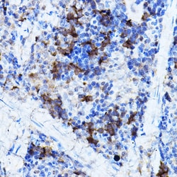 Invitrogen ERK2 Polyclonal Antibody 100 &mu;L; Unconjugated:Antibodies,