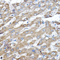 Invitrogen ERK2 Polyclonal Antibody 100 &mu;L; Unconjugated:Antibodies,