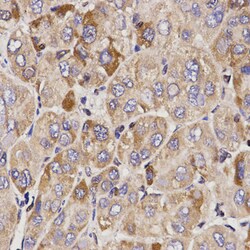 Invitrogen GAS2 Polyclonal Antibody 100 μL; Unconjugated:Antibodies,