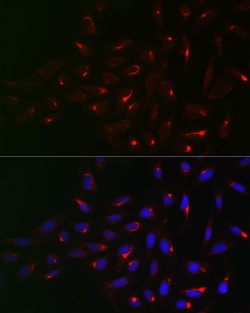 Invitrogen Vimentin Polyclonal Antibody 100 &mu;L; Unconjugated:Antibodies,