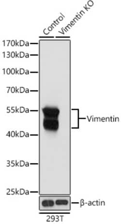 Invitrogen Vimentin Polyclonal Antibody 100 &mu;L; Unconjugated:Antibodies,