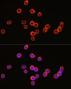 Invitrogen CD64 Polyclonal Antibody 100 &mu;L; Unconjugated:Antibodies,