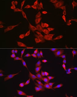 Bax Polyclonal Antibody:Antibodies, Polyclonal