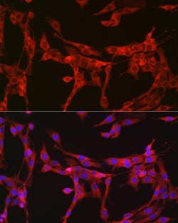 Bax Polyclonal Antibody:Antibodies, Polyclonal