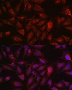 Bax Polyclonal Antibody:Antibodies, Polyclonal