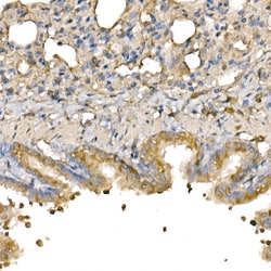 Bax Polyclonal Antibody:Antibodies, Polyclonal