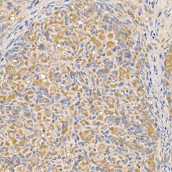 Bax Polyclonal Antibody:Antibodies, Polyclonal