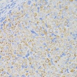 Invitrogen ACADL Polyclonal Antibody 100 &mu;L; Unconjugated:Antibodies,