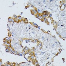 Invitrogen ACADL Polyclonal Antibody 100 &mu;L; Unconjugated:Antibodies,