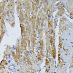 Invitrogen ACADL Polyclonal Antibody 100 &mu;L; Unconjugated:Antibodies,
