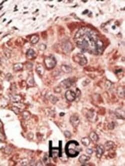 Invitrogen Recoverin Polyclonal Antibody 400 &mu;L; Unconjugated:Antibodies,