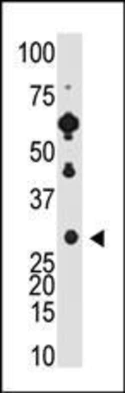 Invitrogen Recoverin Polyclonal Antibody 400 &mu;L; Unconjugated:Antibodies,