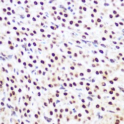 Invitrogen SP3 Polyclonal Antibody 100 &mu;L; Unconjugated:Antibodies,