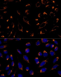 Invitrogen PRDX3 Polyclonal Antibody 100 &mu;L; Unconjugated:Antibodies,