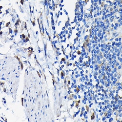 Invitrogen STK19 Polyclonal Antibody 100 &mu;L; Unconjugated:Antibodies,