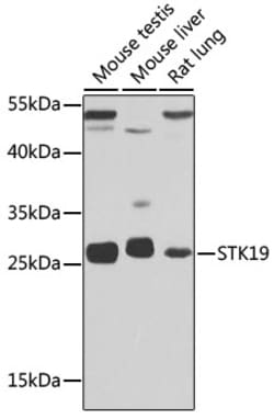 Invitrogen STK19 Polyclonal Antibody 100 &mu;L; Unconjugated:Antibodies,