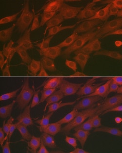 Invitrogen SOD2 (MnSOD) Polyclonal Antibody 100 &mu;L; Unconjugated:Antibodies,