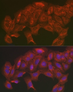 Invitrogen SOD2 (MnSOD) Polyclonal Antibody 100 &mu;L; Unconjugated:Antibodies,