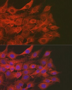 Invitrogen SOD2 (MnSOD) Polyclonal Antibody 100 &mu;L; Unconjugated:Antibodies,