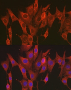 Invitrogen SOD2 (MnSOD) Polyclonal Antibody 100 &mu;L; Unconjugated:Antibodies,