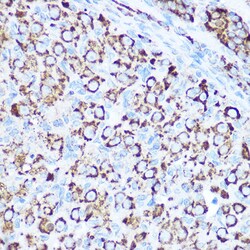 Invitrogen SOD2 (MnSOD) Polyclonal Antibody 100 &mu;L; Unconjugated:Antibodies,