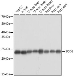 Invitrogen SOD2 (MnSOD) Polyclonal Antibody 100 &mu;L; Unconjugated:Antibodies,