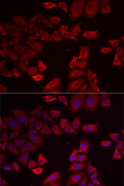 Invitrogen SEPHS1 Polyclonal Antibody 100 &mu;L; Unconjugated:Antibodies,