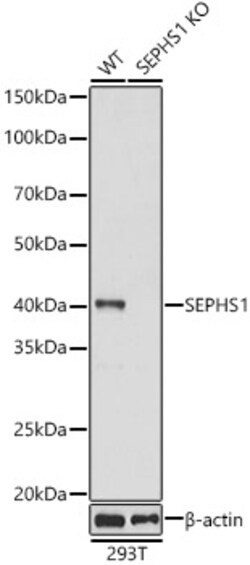 Invitrogen SEPHS1 Polyclonal Antibody 100 &mu;L; Unconjugated:Antibodies,