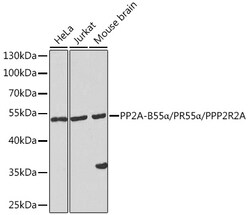 Invitrogen PPP2R2A Polyclonal Antibody 100 &mu;L; Unconjugated:Antibodies,