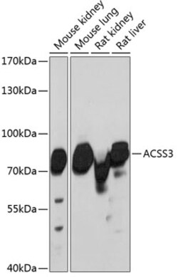 Invitrogen ACSS3 Polyclonal Antibody 100 &mu;L; Unconjugated:Antibodies,