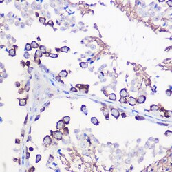Invitrogen DAZL Polyclonal Antibody 100 &mu;L; Unconjugated:Antibodies,