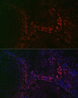 Invitrogen DAZL Polyclonal Antibody 100 &mu;L; Unconjugated:Antibodies,