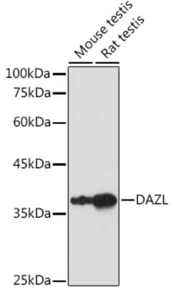 Invitrogen DAZL Polyclonal Antibody 100 &mu;L; Unconjugated:Antibodies,