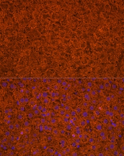 Invitrogen ApoC3 Polyclonal Antibody 100 &mu;L | Buy Online | Invitrogen&trade; | Fisher Scientific