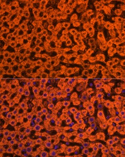 Invitrogen ApoC3 Polyclonal Antibody 100 &mu;L | Buy Online | Invitrogen&trade; | Fisher Scientific